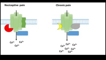 Proteine ​​și durere cronică: o abordare cuprinzătoare